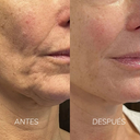 Kit Glow-Aging