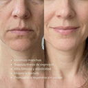 Suero Retinol 0.15%