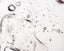 El Retinol, también conocido como vitamina A, logra revertir en cierta medida los daños causados por la luz UV. Suaviza el aspecto de manchas y arrugas, y da mayor grosor a la piel.